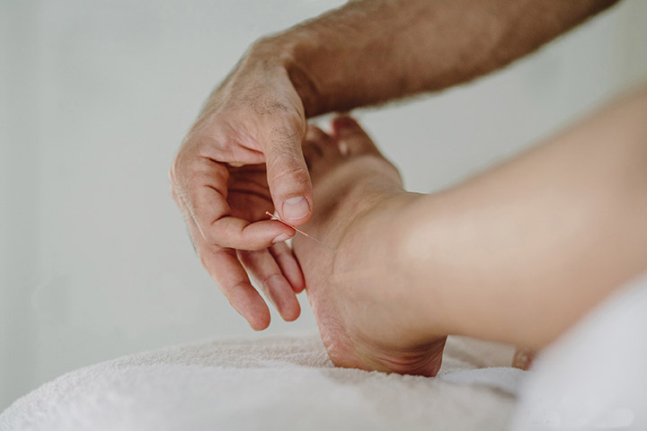 Acupuntura